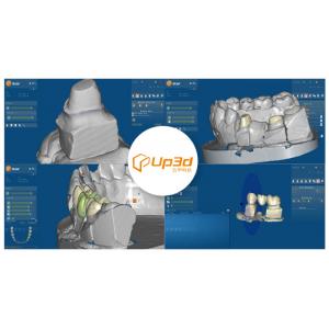 UPCAD for dental design software